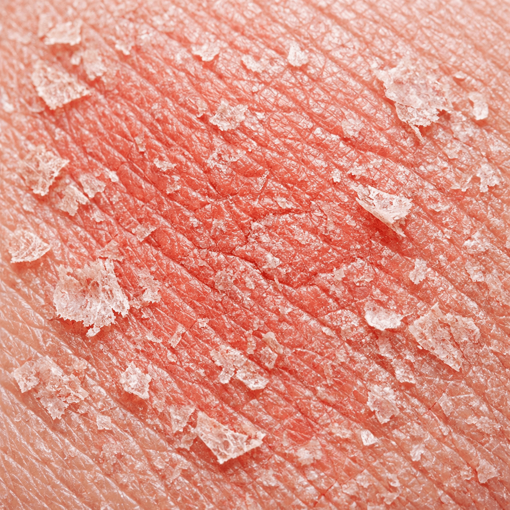 Are You Over-Exfoliating Without Realizing It? (Signs You’re Damaging Your&nbsp;Skin)